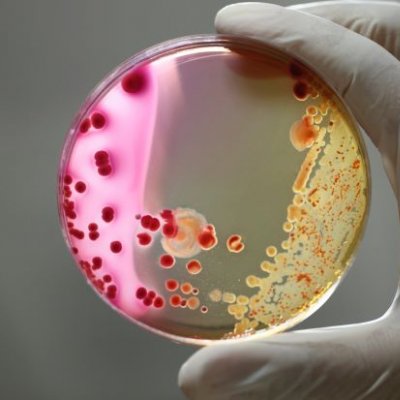 A gloved hand holds a petrie dish with two different forms of bacteria - one white, the other pink with red dots.